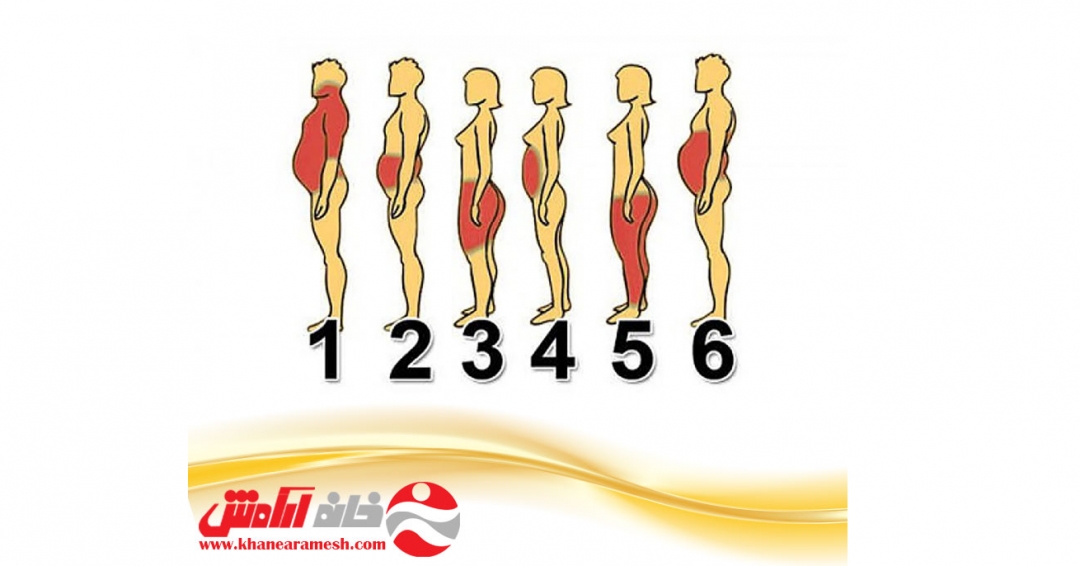 انواع چاقی انواع چاقی